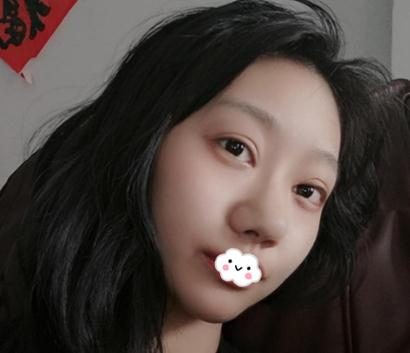 上海伊美爾港華做的3w的鼻子，你們說值不值