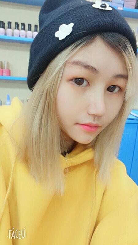 成都蜀尚蓉雅美容整形醫(yī)院做鼻綜合術(shù)后的鼻子恢復(fù)的很不錯(cuò)