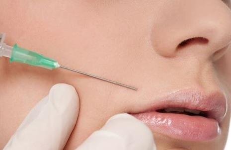 注射填充法令紋的方式有哪些？如何通過醫(yī)美手段祛法令紋？