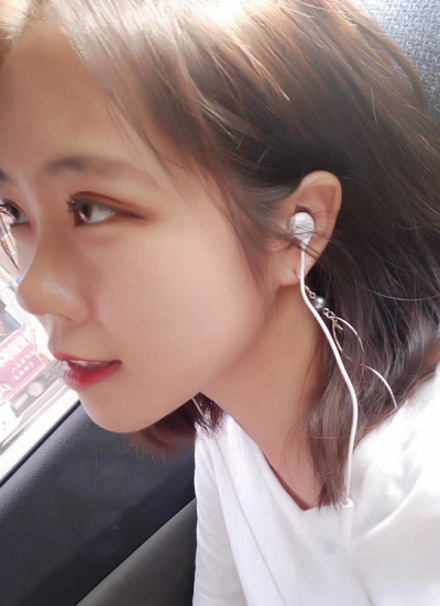 北京東方瑞麗醫(yī)療美容門(mén)診部做雙眼皮手術(shù)后恢復(fù)情況