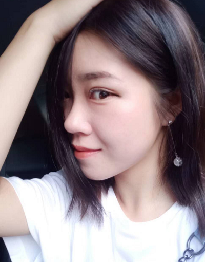 北京東方瑞麗醫(yī)療美容門(mén)診部做雙眼皮手術(shù)后的日?；謴?fù)情況