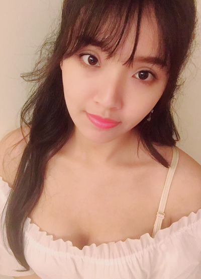 北京藝星醫(yī)療美容醫(yī)院金松做自體脂肪隆胸案例效果分享