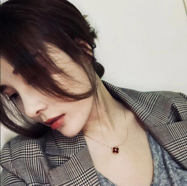 上海藝星醫(yī)療美容醫(yī)院裴宰瑩鼻綜合案例效果分享