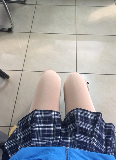 蘇州圣愛(ài)醫(yī)院醫(yī)療美容科做大腿吸脂手術(shù)后的恢復(fù)情況