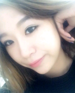 上海時光整形外科醫(yī)院做耳軟骨隆鼻術后最終狀態(tài) 上海時光整形外科醫(yī)院做耳軟骨隆鼻術后最終狀態(tài)