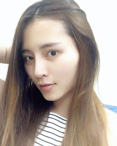 深圳微姿醫(yī)療美容門診部做鼻綜合手術(shù)后的日?；謴?fù)