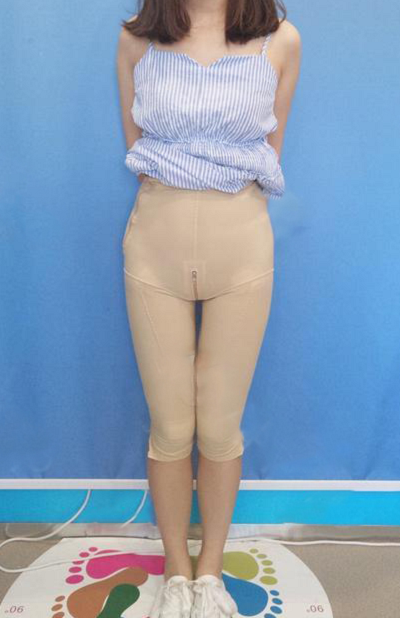 武漢米蘭醫(yī)療美容門診部做全身吸脂手術(shù)后的日常 武漢米蘭醫(yī)療美容門診部做全身吸脂手術(shù)后的日常