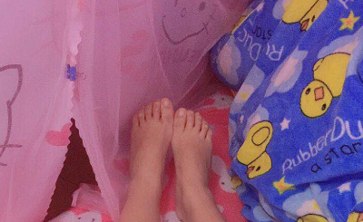 蘇州圣愛(ài)醫(yī)院醫(yī)療美容科做大腿吸脂手術(shù)前