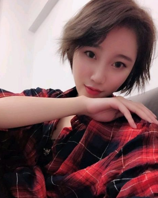 上海時(shí)光整形外科醫(yī)院做鼻綜合手術(shù)后的第三個(gè)月