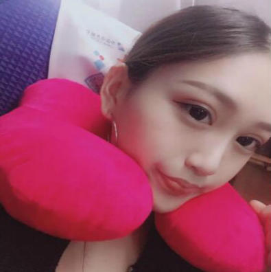 成都美立方（原華博）醫(yī)療美容醫(yī)院做肋軟骨隆鼻手術(shù)后的最終效果