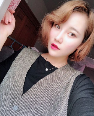 上海時(shí)光整形外科醫(yī)院做鼻綜合手術(shù)后的第一個(gè)月