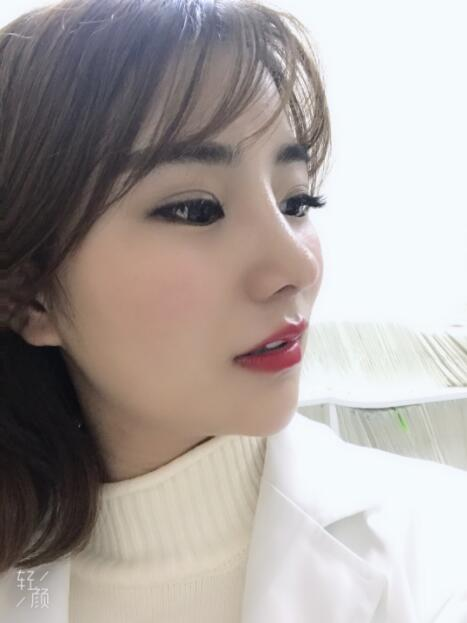 上海美萊醫(yī)療美容門診部盧建隆鼻案例效果分享