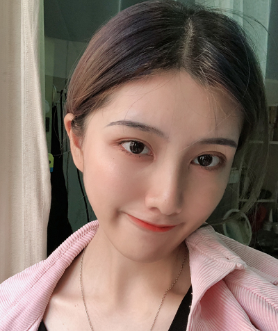 上海港華醫(yī)療美容醫(yī)院做隆鼻手術(shù)后的最終效果 上海港華醫(yī)療美容醫(yī)院做隆鼻手術(shù)后的最終效果