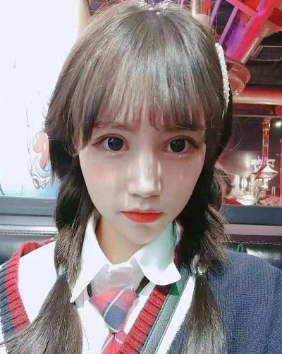 成都美立方（原華博）醫(yī)療美容醫(yī)院做眼部修復(fù)手術(shù)后的三個月