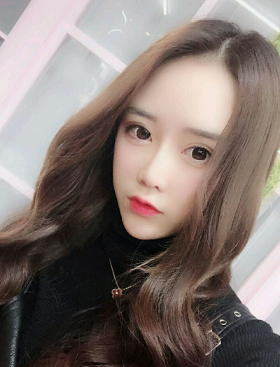 上海伊美爾港華醫(yī)療美容醫(yī)院做自體肋軟骨隆鼻手術(shù)后的最終效果