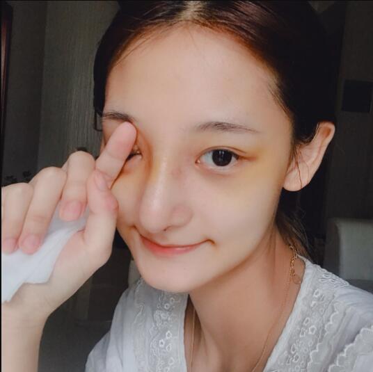 成都蜀尚蓉雅美容整形醫(yī)院做鼻綜合術(shù)后的最終恢復(fù)情況