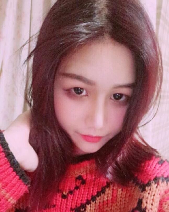 成都蜀尚蓉雅美容整形醫(yī)院做鼻綜合術(shù)后的鼻子美美的