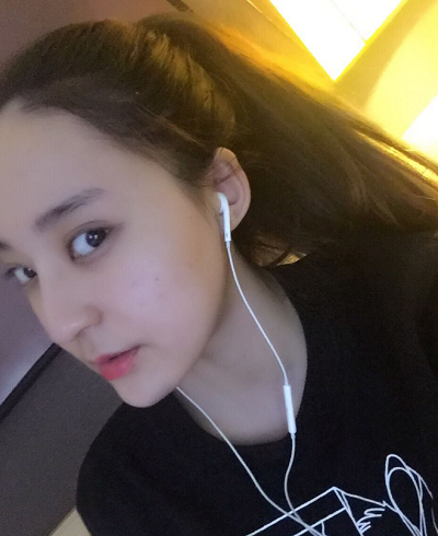 北京京民醫(yī)院（原釣魚臺醫(yī)院）整形外科做下頜骨手術后的最終效果